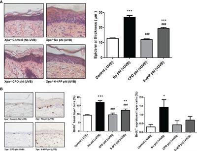 Photorepair of Either CPD or 6-4PP DNA Lesions in Basal Keratinocytes Attenuates Ultraviolet-Induced Skin Effects in Nucleotide Excision Repair Deficient Mice